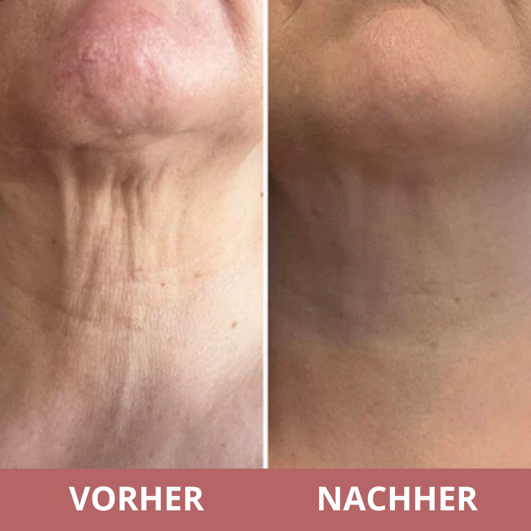 Neck Sculpt Straffende Creme – Für einen jugendlichen, gestrafften Hals
